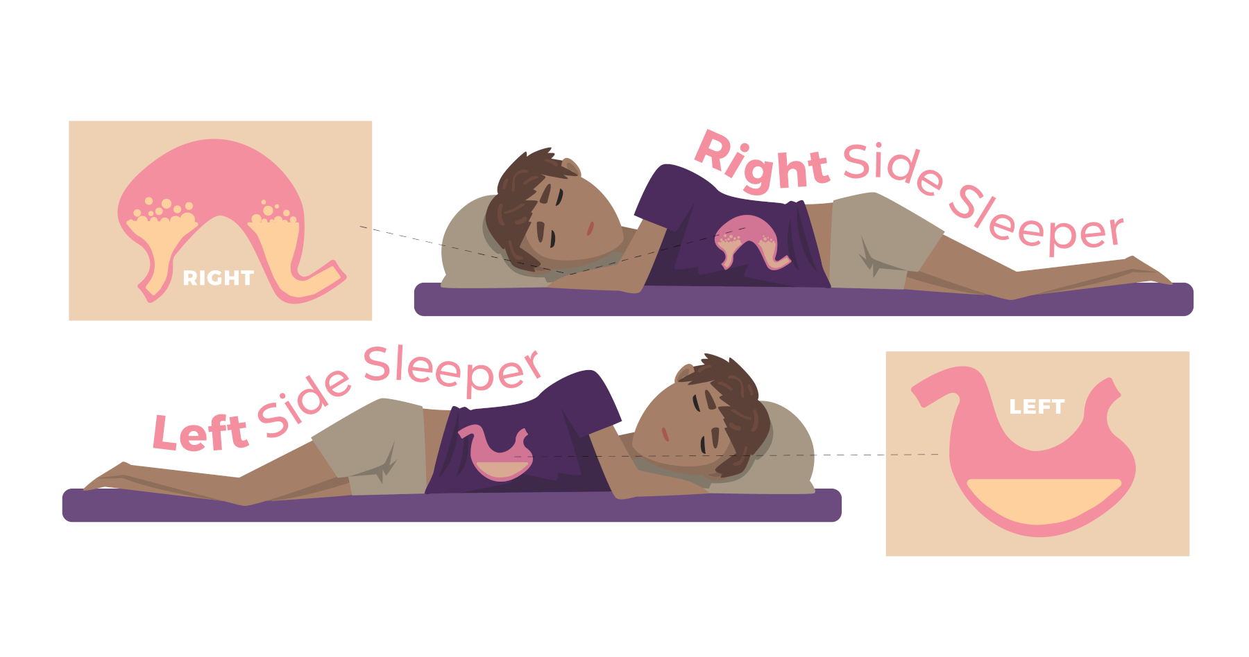 Side Sleeper Problems: 5 Common Issues and Solutions - DOWNLITE